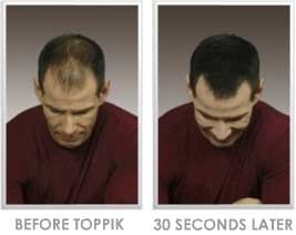 پرپشت کننده مو در 30 ثانیه 100% طبیعی 
