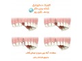 Icon for دندانپزشکی بالوی پور، ارائه دهنده کلیه خدمات دندان پزشکی با قیمت مناسب