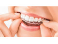 دندان مصنوعی ارزان - دندان سفید