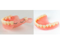 دندان مصنوعی با کیفیت - نخ دندان