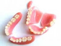 Icon for دندان سازی ارزان