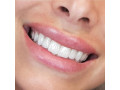 Icon for پایه پلاک  دندان