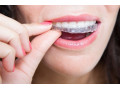 Icon for درمان دندان قروچه