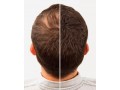 تاپیک اصل ماندگارترین پودرپرپشت کننده مو - پودرپرپشت کننده فوری مو