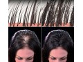 سریعترین راه جبران موهای از دست رفته با پودر پرپشت کننده تاپیک - جبران کننده استاتیکی توان راکتیو