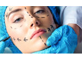 جراحی بینی | جراحی زیبایی شکم | لیپوماتیک