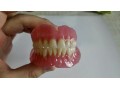 دندانسازی - دندانسازی