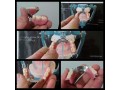 دندانسازی - دندانسازی منطقه 4