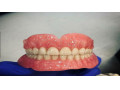 ساخت انواع دندان مصنوعی  - دندان درد