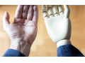 AD is: ساخت اندام مصنوعی از جمله : پروتز دست مصنوعی و پا 