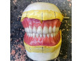 ساخت انواع دندان مصنوعی،ساخت پلاک کروم کبالت براساس فک،ساخت پروتز فلکسی و… - پروتز صورت