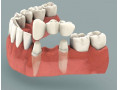 Icon for بریج دندان در کرج