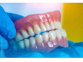 Icon for ساخت دندان مصنوعی رایگان در تهران