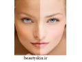 Icon for قویترین کرم سفید کننده صورت
