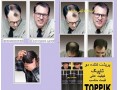فروش بهترین پودر مو سوپر تاپیک - سوپر مارکت آنلاین اصفهان