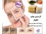 کرم دور چشم خاویار