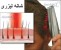 جلوگیری از ریزش مو و تقویت مو و رشد موهای ریخته شده در زنان و مردان - فروش فوق العاده شانه لیزری مو هیرمکس امریکایی