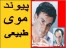 پیوند و کاشت موی طبیعی