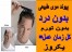 پیوند،ترمیم و کاشت موی طبیعی-زنده و دارای رشد طبیعی-