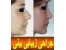 جراحی پلاستیک بینی-جراحی زیبایی صورت-جراحی پلاستیک ترمیمی-کشیدن پوست صورت-ساکشن ش�